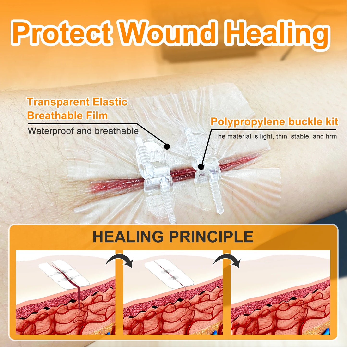 2PCS Painless Wound Closure Device